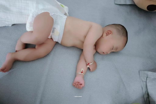 阜阳宝宝头上长痱子